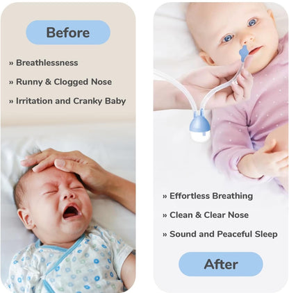 Nasal Cleaner For Baby Painless Relief from Mucus and Blocked Nose image 6